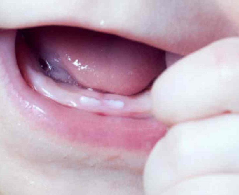 Cómo calmar a tu bebé cuando le salgan sus primeros dientes