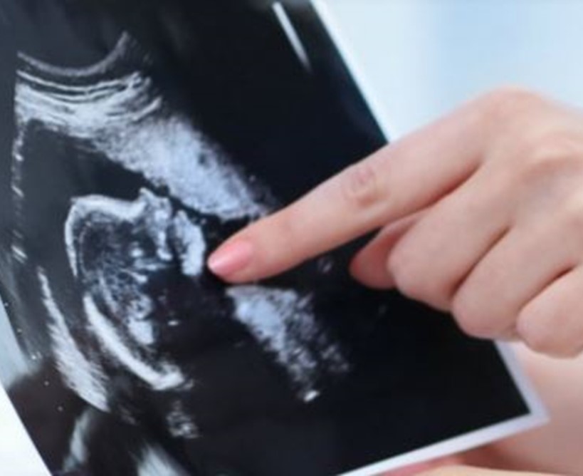 ¿Por qué debes visitar periódicamente a tu médico durante el embarazo?
